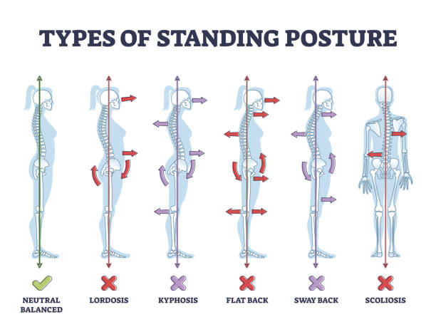 Types Of Posture