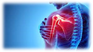 Shoulder Pain